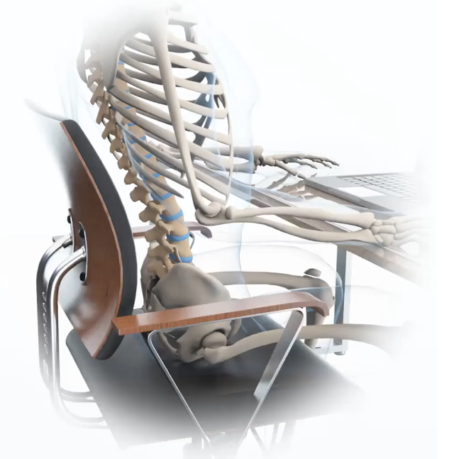 Why traditional backrests fail — skeletal posture analysis